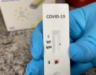 Free COVID-19 Antibody  at Raymond James Stadium Starting Today