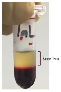 PCRopsis™ BCS Nano enriches blood cells and mediates Next Generation Direct PCR™ from whole blood without equipment