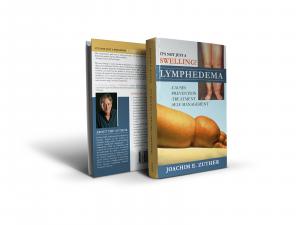 New Book on Lymphedema and Lipedema geared toward the Patient